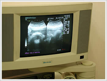 Warabi Hospital visit, February 4, 2003: click for larger image (34K)